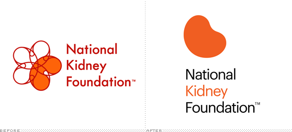 National Kidney Foundation Logo, Before and After